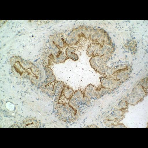  NCBI Organism:Homo sapiens; Cell Types:endocrine-paracrine cell of prostate gland, basal cell of prostate epithelium, luminal cell of prostate epithelium, blood vessel endothelial cell, perineural cell, sheath cell, leukocyte, prostate stromal cell, smooth muscle cell of prostate; Cell Components:nucleus, cell surface;