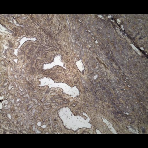  NCBI Organism:Homo sapiens; Cell Types:endocrine-paracrine cell of prostate gland, basal cell of prostate epithelium, luminal cell of prostate epithelium, blood vessel endothelial cell, perineural cell, sheath cell, leukocyte, prostate stromal cell, smooth muscle cell of prostate; Cell Components:nucleus, cell surface;