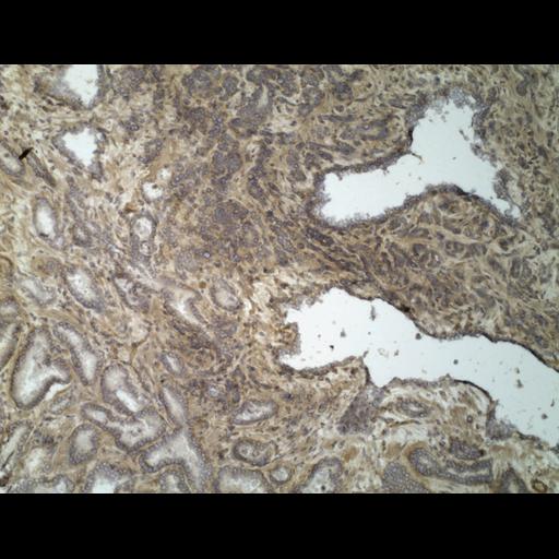  NCBI Organism:Homo sapiens; Cell Types:endocrine-paracrine cell of prostate gland, basal cell of prostate epithelium, luminal cell of prostate epithelium, blood vessel endothelial cell, perineural cell, sheath cell, leukocyte, prostate stromal cell, smooth muscle cell of prostate; Cell Components:nucleus, cell surface;