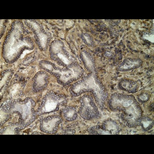 NCBI Organism:Homo sapiens; Cell Types:endocrine-paracrine cell of prostate gland, basal cell of prostate epithelium, luminal cell of prostate epithelium, blood vessel endothelial cell, perineural cell, sheath cell, leukocyte, prostate stromal cell, smooth muscle cell of prostate; Cell Components:nucleus, cell surface;