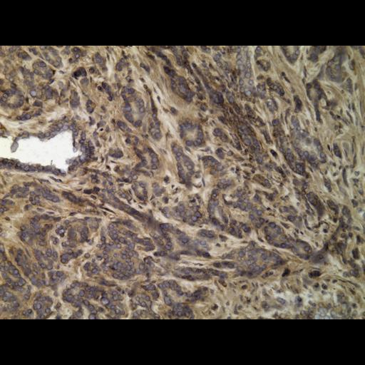  NCBI Organism:Homo sapiens; Cell Types:endocrine-paracrine cell of prostate gland, basal cell of prostate epithelium, luminal cell of prostate epithelium, blood vessel endothelial cell, perineural cell, sheath cell, leukocyte, prostate stromal cell, smooth muscle cell of prostate; Cell Components:nucleus, cell surface;