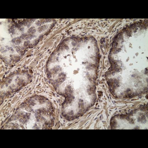  NCBI Organism:Homo sapiens; Cell Types:endocrine-paracrine cell of prostate gland, basal cell of prostate epithelium, luminal cell of prostate epithelium, blood vessel endothelial cell, perineural cell, sheath cell, leukocyte, prostate stromal cell, smooth muscle cell of prostate; Cell Components:nucleus, cell surface;