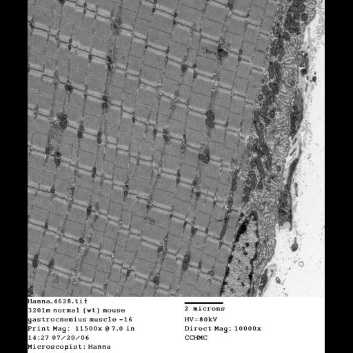  NCBI Organism:Mus musculus; Cell Types:skeletal muscle cell Cell Components:dystroglycan complex Biological process:plasma membrane organization