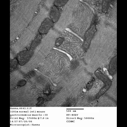  NCBI Organism:Mus musculus; Cell Types:skeletal muscle cell Cell Components:dystroglycan complex Biological process:plasma membrane organization