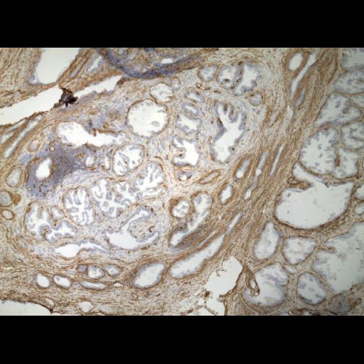  NCBI Organism:Homo sapiens; Cell Types:endocrine-paracrine cell of prostate gland, basal cell of prostate epithelium, luminal cell of prostate epithelium, blood vessel endothelial cell, perineural cell, sheath cell, leukocyte, prostate stromal cell, smooth muscle cell of prostate; Cell Components:nucleus, cell surface;