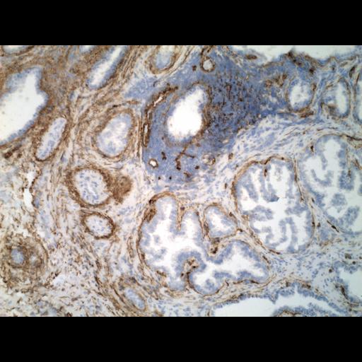  NCBI Organism:Homo sapiens; Cell Types:endocrine-paracrine cell of prostate gland, basal cell of prostate epithelium, luminal cell of prostate epithelium, blood vessel endothelial cell, perineural cell, sheath cell, leukocyte, prostate stromal cell, smooth muscle cell of prostate; Cell Components:nucleus, cell surface;