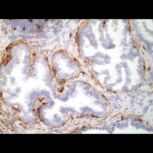  NCBI Organism:Homo sapiens; Cell Types:endocrine-paracrine cell of prostate gland, basal cell of prostate epithelium, luminal cell of prostate epithelium, blood vessel endothelial cell, perineural cell, sheath cell, leukocyte, prostate stromal cell, smooth muscle cell of prostate; Cell Components:nucleus, cell surface;