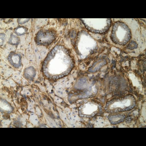  NCBI Organism:Homo sapiens; Cell Types:endocrine-paracrine cell of prostate gland, basal cell of prostate epithelium, luminal cell of prostate epithelium, blood vessel endothelial cell, perineural cell, sheath cell, leukocyte, prostate stromal cell, smooth muscle cell of prostate; Cell Components:nucleus, cell surface;