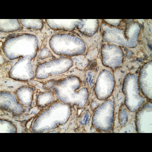  NCBI Organism:Homo sapiens; Cell Types:endocrine-paracrine cell of prostate gland, basal cell of prostate epithelium, luminal cell of prostate epithelium, blood vessel endothelial cell, perineural cell, sheath cell, leukocyte, prostate stromal cell, smooth muscle cell of prostate; Cell Components:nucleus, cell surface;