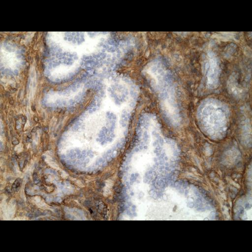  NCBI Organism:Homo sapiens; Cell Types:endocrine-paracrine cell of prostate gland, basal cell of prostate epithelium, luminal cell of prostate epithelium, blood vessel endothelial cell, perineural cell, sheath cell, leukocyte, prostate stromal cell, smooth muscle cell of prostate; Cell Components:nucleus, cell surface;