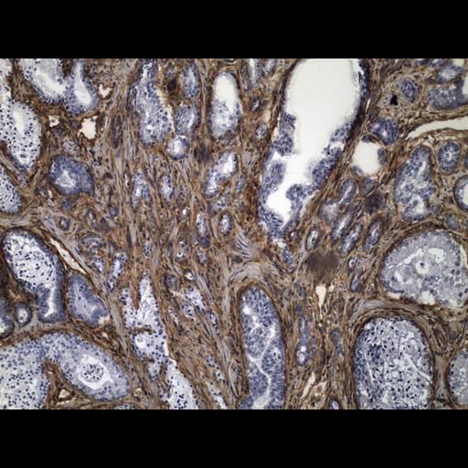  NCBI Organism:Homo sapiens; Cell Types:endocrine-paracrine cell of prostate gland, basal cell of prostate epithelium, luminal cell of prostate epithelium, blood vessel endothelial cell, perineural cell, sheath cell, leukocyte, prostate stromal cell, smooth muscle cell of prostate; Cell Components:nucleus, cell surface;