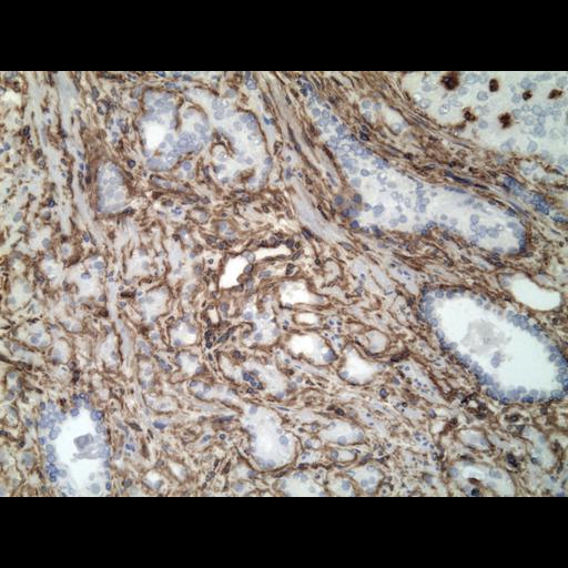  NCBI Organism:Homo sapiens; Cell Types:endocrine-paracrine cell of prostate gland, basal cell of prostate epithelium, luminal cell of prostate epithelium, blood vessel endothelial cell, perineural cell, sheath cell, leukocyte, prostate stromal cell, smooth muscle cell of prostate; Cell Components:nucleus, cell surface;