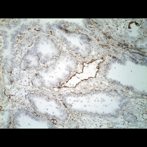  NCBI Organism:Homo sapiens; Cell Types:endocrine-paracrine cell of prostate gland, basal cell of prostate epithelium, luminal cell of prostate epithelium, blood vessel endothelial cell, perineural cell, sheath cell, leukocyte, prostate stromal cell, smooth muscle cell of prostate; Cell Components:nucleus, cell surface;