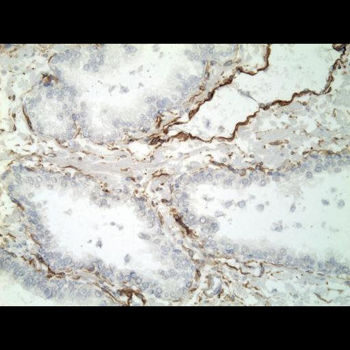  NCBI Organism:Homo sapiens; Cell Types:endocrine-paracrine cell of prostate gland, basal cell of prostate epithelium, luminal cell of prostate epithelium, blood vessel endothelial cell, perineural cell, sheath cell, leukocyte, prostate stromal cell, smooth muscle cell of prostate; Cell Components:nucleus, cell surface;