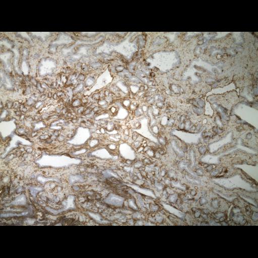  NCBI Organism:Homo sapiens; Cell Types:endocrine-paracrine cell of prostate gland, basal cell of prostate epithelium, luminal cell of prostate epithelium, blood vessel endothelial cell, perineural cell, sheath cell, leukocyte, prostate stromal cell, smooth muscle cell of prostate; Cell Components:nucleus, cell surface;