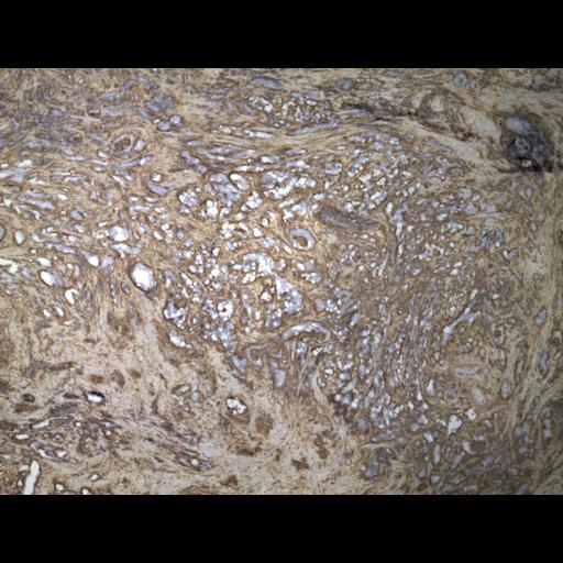  NCBI Organism:Homo sapiens; Cell Types:endocrine-paracrine cell of prostate gland, basal cell of prostate epithelium, luminal cell of prostate epithelium, blood vessel endothelial cell, perineural cell, sheath cell, leukocyte, prostate stromal cell, smooth muscle cell of prostate; Cell Components:nucleus, cell surface;