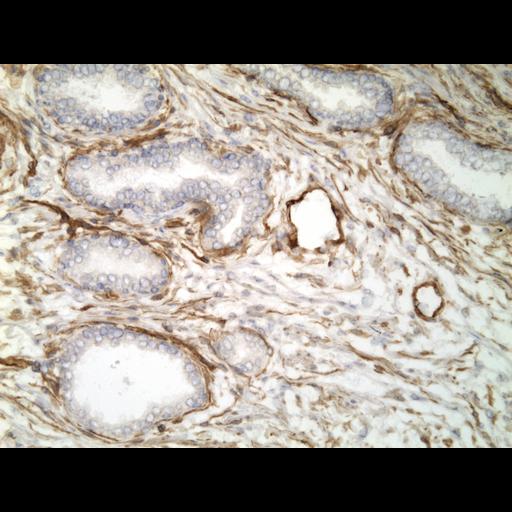  NCBI Organism:Homo sapiens; Cell Types:endocrine-paracrine cell of prostate gland, basal cell of prostate epithelium, luminal cell of prostate epithelium, blood vessel endothelial cell, perineural cell, sheath cell, leukocyte, prostate stromal cell, smooth muscle cell of prostate; Cell Components:nucleus, cell surface;