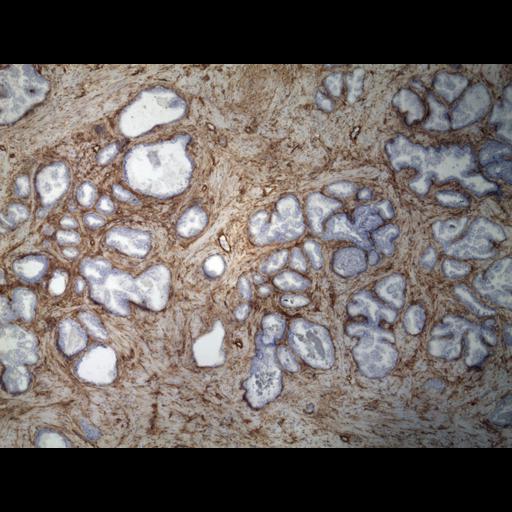  NCBI Organism:Homo sapiens; Cell Types:endocrine-paracrine cell of prostate gland, basal cell of prostate epithelium, luminal cell of prostate epithelium, blood vessel endothelial cell, perineural cell, sheath cell, leukocyte, prostate stromal cell, smooth muscle cell of prostate; Cell Components:nucleus, cell surface;