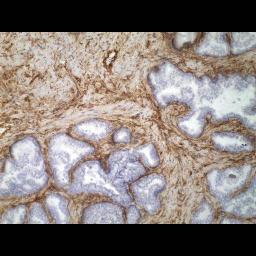  NCBI Organism:Homo sapiens; Cell Types:endocrine-paracrine cell of prostate gland, basal cell of prostate epithelium, luminal cell of prostate epithelium, blood vessel endothelial cell, perineural cell, sheath cell, leukocyte, prostate stromal cell, smooth muscle cell of prostate; Cell Components:nucleus, cell surface;