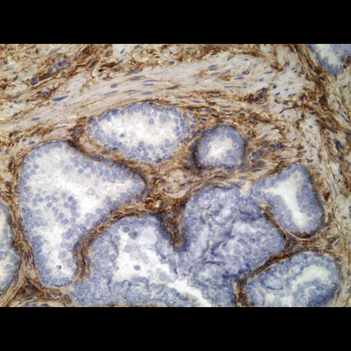  NCBI Organism:Homo sapiens; Cell Types:endocrine-paracrine cell of prostate gland, basal cell of prostate epithelium, luminal cell of prostate epithelium, blood vessel endothelial cell, perineural cell, sheath cell, leukocyte, prostate stromal cell, smooth muscle cell of prostate; Cell Components:nucleus, cell surface;