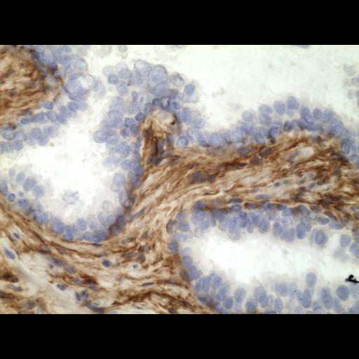  NCBI Organism:Homo sapiens; Cell Types:endocrine-paracrine cell of prostate gland, basal cell of prostate epithelium, luminal cell of prostate epithelium, blood vessel endothelial cell, perineural cell, sheath cell, leukocyte, prostate stromal cell, smooth muscle cell of prostate; Cell Components:nucleus, cell surface;