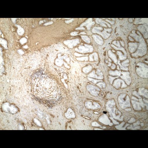  NCBI Organism:Homo sapiens; Cell Types:endocrine-paracrine cell of prostate gland, basal cell of prostate epithelium, luminal cell of prostate epithelium, blood vessel endothelial cell, perineural cell, sheath cell, leukocyte, prostate stromal cell, smooth muscle cell of prostate; Cell Components:nucleus, cell surface;