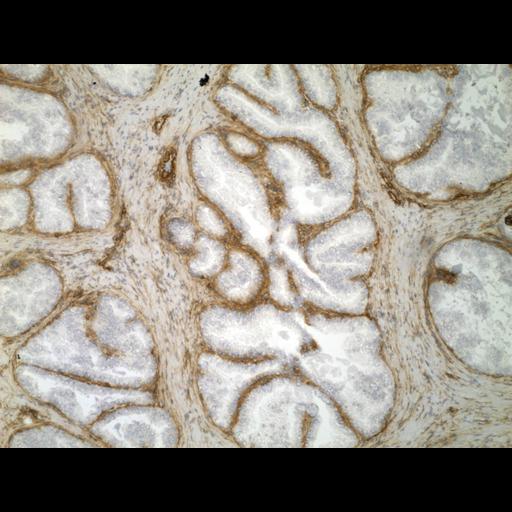  NCBI Organism:Homo sapiens; Cell Types:endocrine-paracrine cell of prostate gland, basal cell of prostate epithelium, luminal cell of prostate epithelium, blood vessel endothelial cell, perineural cell, sheath cell, leukocyte, prostate stromal cell, smooth muscle cell of prostate; Cell Components:nucleus, cell surface;