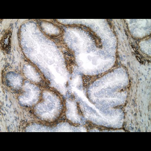  NCBI Organism:Homo sapiens; Cell Types:endocrine-paracrine cell of prostate gland, basal cell of prostate epithelium, luminal cell of prostate epithelium, blood vessel endothelial cell, perineural cell, sheath cell, leukocyte, prostate stromal cell, smooth muscle cell of prostate; Cell Components:nucleus, cell surface;