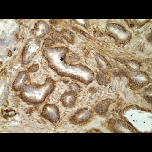  NCBI Organism:Homo sapiens; Cell Types:endocrine-paracrine cell of prostate gland, basal cell of prostate epithelium, luminal cell of prostate epithelium, blood vessel endothelial cell, perineural cell, sheath cell, leukocyte, prostate stromal cell, smooth muscle cell of prostate; Cell Components:nucleus, cell surface;