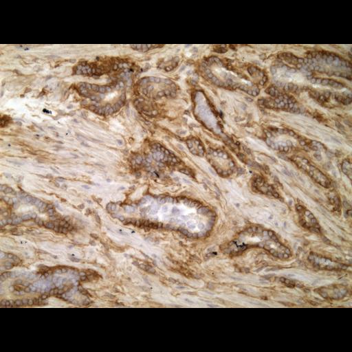  NCBI Organism:Homo sapiens; Cell Types:endocrine-paracrine cell of prostate gland, basal cell of prostate epithelium, luminal cell of prostate epithelium, blood vessel endothelial cell, perineural cell, sheath cell, leukocyte, prostate stromal cell, smooth muscle cell of prostate; Cell Components:nucleus, cell surface;