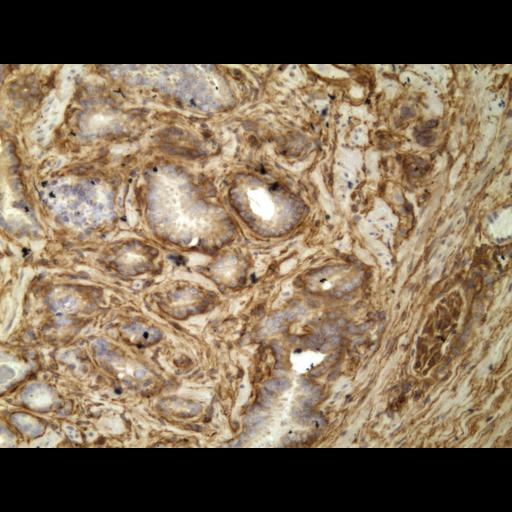  NCBI Organism:Homo sapiens; Cell Types:endocrine-paracrine cell of prostate gland, basal cell of prostate epithelium, luminal cell of prostate epithelium, blood vessel endothelial cell, perineural cell, sheath cell, leukocyte, prostate stromal cell, smooth muscle cell of prostate; Cell Components:nucleus, cell surface;