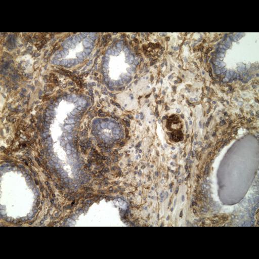  NCBI Organism:Homo sapiens; Cell Types:endocrine-paracrine cell of prostate gland, basal cell of prostate epithelium, luminal cell of prostate epithelium, blood vessel endothelial cell, perineural cell, sheath cell, leukocyte, prostate stromal cell, smooth muscle cell of prostate; Cell Components:nucleus, cell surface;