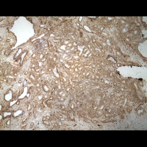  NCBI Organism:Homo sapiens; Cell Types:endocrine-paracrine cell of prostate gland, basal cell of prostate epithelium, luminal cell of prostate epithelium, blood vessel endothelial cell, perineural cell, sheath cell, leukocyte, prostate stromal cell, smooth muscle cell of prostate; Cell Components:nucleus, cell surface;