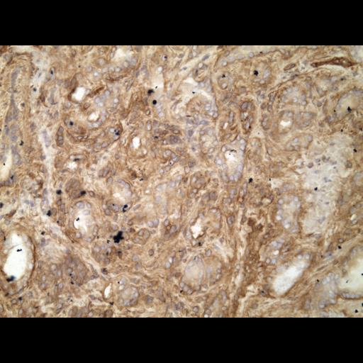  NCBI Organism:Homo sapiens; Cell Types:endocrine-paracrine cell of prostate gland, basal cell of prostate epithelium, luminal cell of prostate epithelium, blood vessel endothelial cell, perineural cell, sheath cell, leukocyte, prostate stromal cell, smooth muscle cell of prostate; Cell Components:nucleus, cell surface;