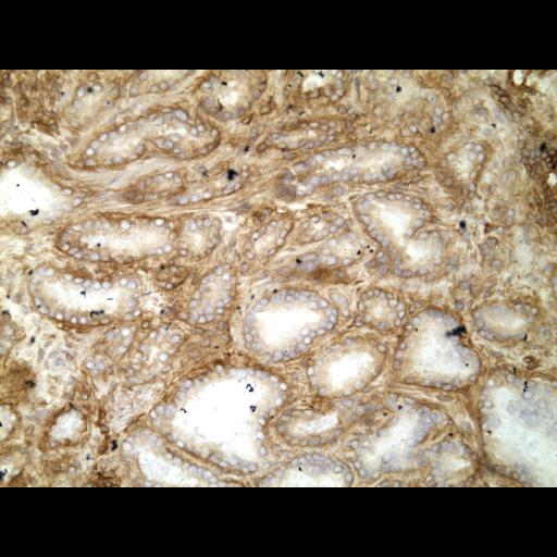  NCBI Organism:Homo sapiens; Cell Types:endocrine-paracrine cell of prostate gland, basal cell of prostate epithelium, luminal cell of prostate epithelium, blood vessel endothelial cell, perineural cell, sheath cell, leukocyte, prostate stromal cell, smooth muscle cell of prostate; Cell Components:nucleus, cell surface;