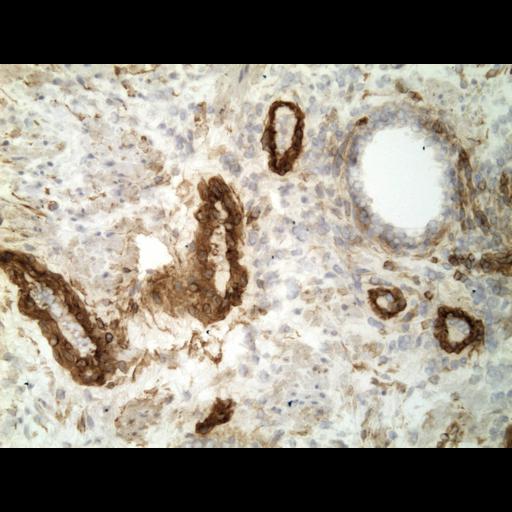  NCBI Organism:Homo sapiens; Cell Types:endocrine-paracrine cell of prostate gland, basal cell of prostate epithelium, luminal cell of prostate epithelium, blood vessel endothelial cell, perineural cell, sheath cell, leukocyte, prostate stromal cell, smooth muscle cell of prostate; Cell Components:nucleus, cell surface;