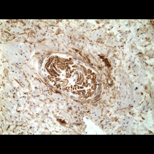  NCBI Organism:Homo sapiens; Cell Types:endocrine-paracrine cell of prostate gland, basal cell of prostate epithelium, luminal cell of prostate epithelium, blood vessel endothelial cell, perineural cell, sheath cell, leukocyte, prostate stromal cell, smooth muscle cell of prostate; Cell Components:nucleus, cell surface;