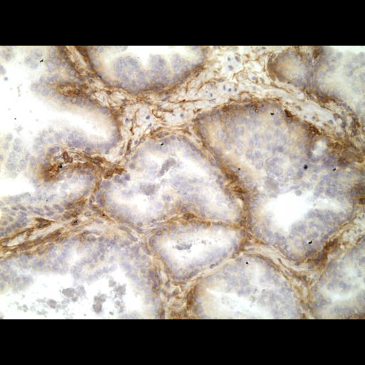  NCBI Organism:Homo sapiens; Cell Types:endocrine-paracrine cell of prostate gland, basal cell of prostate epithelium, luminal cell of prostate epithelium, blood vessel endothelial cell, perineural cell, sheath cell, leukocyte, prostate stromal cell, smooth muscle cell of prostate; Cell Components:nucleus, cell surface;