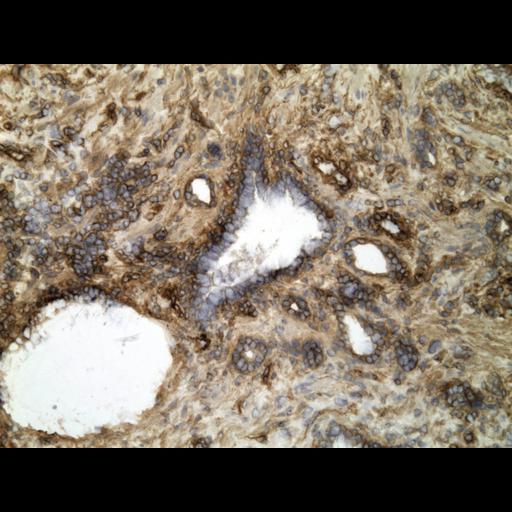  NCBI Organism:Homo sapiens; Cell Types:endocrine-paracrine cell of prostate gland, basal cell of prostate epithelium, luminal cell of prostate epithelium, blood vessel endothelial cell, perineural cell, sheath cell, leukocyte, prostate stromal cell, smooth muscle cell of prostate; Cell Components:nucleus, cell surface;