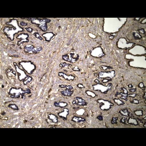  NCBI Organism:Homo sapiens; Cell Types:endocrine-paracrine cell of prostate gland, basal cell of prostate epithelium, luminal cell of prostate epithelium, blood vessel endothelial cell, perineural cell, sheath cell, leukocyte, prostate stromal cell, smooth muscle cell of prostate; Cell Components:nucleus, cell surface;