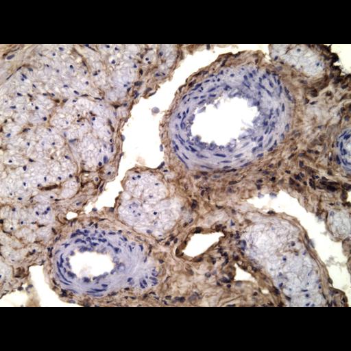  NCBI Organism:Homo sapiens; Cell Types:endocrine-paracrine cell of prostate gland, basal cell of prostate epithelium, luminal cell of prostate epithelium, blood vessel endothelial cell, perineural cell, sheath cell, leukocyte, prostate stromal cell, smooth muscle cell of prostate; Cell Components:nucleus, cell surface;