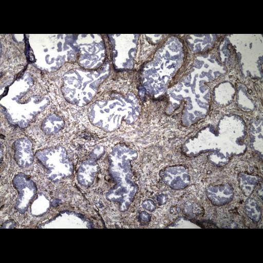  NCBI Organism:Homo sapiens; Cell Types:endocrine-paracrine cell of prostate gland, basal cell of prostate epithelium, luminal cell of prostate epithelium, blood vessel endothelial cell, perineural cell, sheath cell, leukocyte, prostate stromal cell, smooth muscle cell of prostate; Cell Components:nucleus, cell surface;