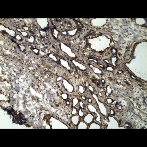  NCBI Organism:Homo sapiens; Cell Types:endocrine-paracrine cell of prostate gland, basal cell of prostate epithelium, luminal cell of prostate epithelium, blood vessel endothelial cell, perineural cell, sheath cell, leukocyte, prostate stromal cell, smooth muscle cell of prostate; Cell Components:nucleus, cell surface;