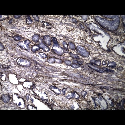  NCBI Organism:Homo sapiens; Cell Types:endocrine-paracrine cell of prostate gland, basal cell of prostate epithelium, luminal cell of prostate epithelium, blood vessel endothelial cell, perineural cell, sheath cell, leukocyte, prostate stromal cell, smooth muscle cell of prostate; Cell Components:nucleus, cell surface;