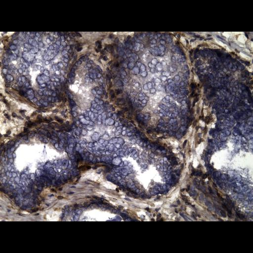  NCBI Organism:Homo sapiens; Cell Types:endocrine-paracrine cell of prostate gland, basal cell of prostate epithelium, luminal cell of prostate epithelium, blood vessel endothelial cell, perineural cell, sheath cell, leukocyte, prostate stromal cell, smooth muscle cell of prostate; Cell Components:nucleus, cell surface;