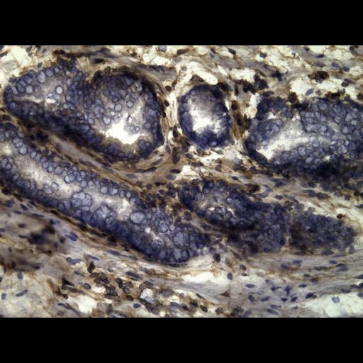  NCBI Organism:Homo sapiens; Cell Types:endocrine-paracrine cell of prostate gland, basal cell of prostate epithelium, luminal cell of prostate epithelium, blood vessel endothelial cell, perineural cell, sheath cell, leukocyte, prostate stromal cell, smooth muscle cell of prostate; Cell Components:nucleus, cell surface;