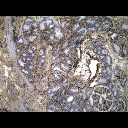  NCBI Organism:Homo sapiens; Cell Types:endocrine-paracrine cell of prostate gland, basal cell of prostate epithelium, luminal cell of prostate epithelium, blood vessel endothelial cell, perineural cell, sheath cell, leukocyte, prostate stromal cell, smooth muscle cell of prostate; Cell Components:nucleus, cell surface;