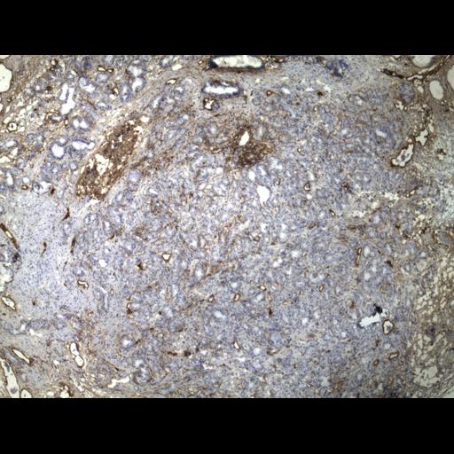  NCBI Organism:Homo sapiens; Cell Types:endocrine-paracrine cell of prostate gland, basal cell of prostate epithelium, luminal cell of prostate epithelium, blood vessel endothelial cell, perineural cell, sheath cell, leukocyte, prostate stromal cell, smooth muscle cell of prostate; Cell Components:nucleus, cell surface;