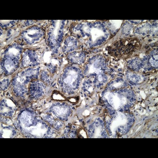  NCBI Organism:Homo sapiens; Cell Types:endocrine-paracrine cell of prostate gland, basal cell of prostate epithelium, luminal cell of prostate epithelium, blood vessel endothelial cell, perineural cell, sheath cell, leukocyte, prostate stromal cell, smooth muscle cell of prostate; Cell Components:nucleus, cell surface;