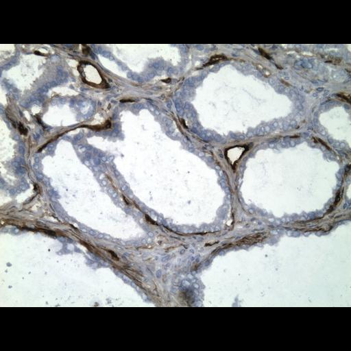  NCBI Organism:Homo sapiens; Cell Types:endocrine-paracrine cell of prostate gland, basal cell of prostate epithelium, luminal cell of prostate epithelium, blood vessel endothelial cell, perineural cell, sheath cell, leukocyte, prostate stromal cell, smooth muscle cell of prostate; Cell Components:nucleus, cell surface;